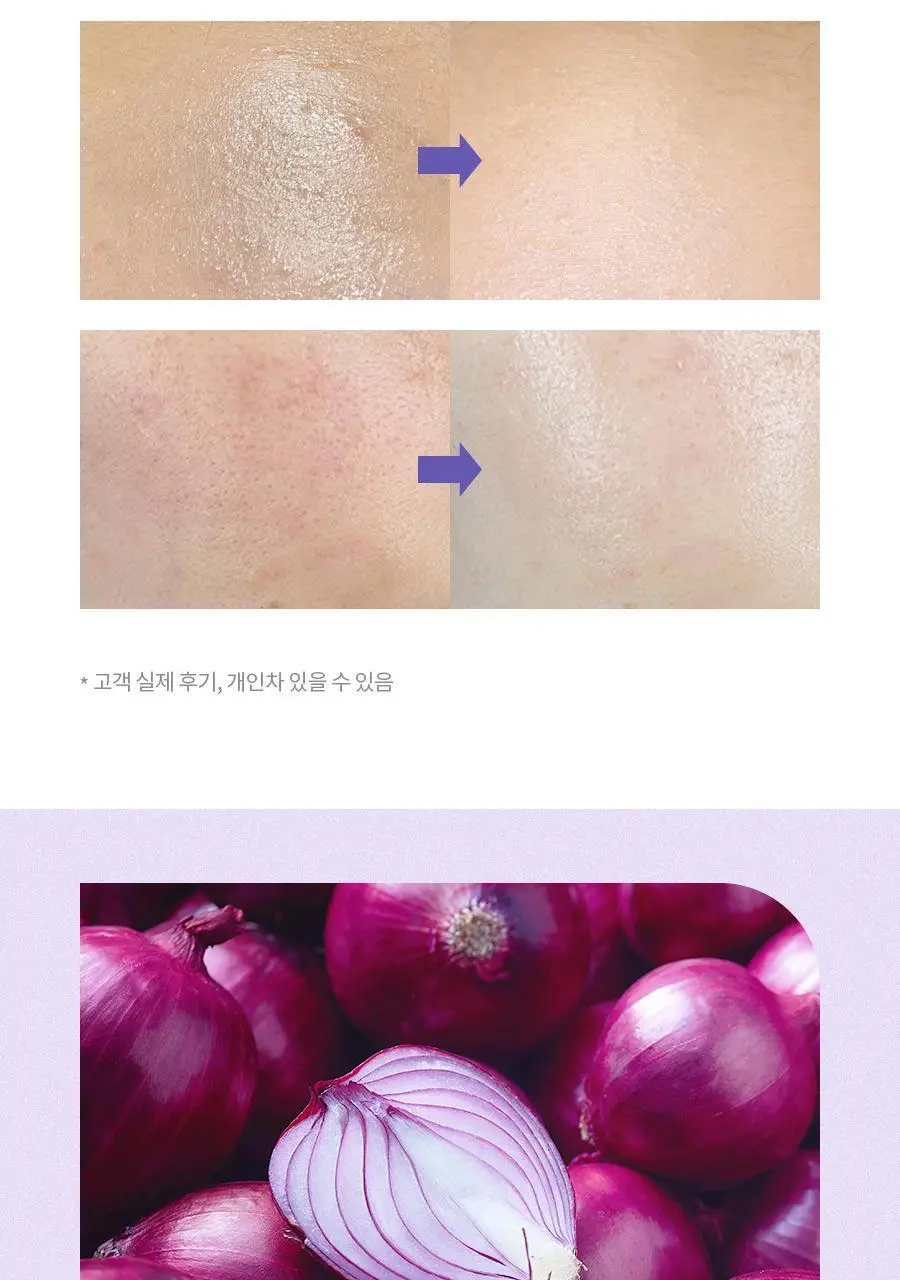 [NCT 재민PICK] 이즈앤트리 어니언 뉴페어 클리어 패드 60매 (+20매 리필 증정기획) 상세페이지 33
